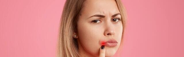 Kako sakriti herpes na usni: par trikova