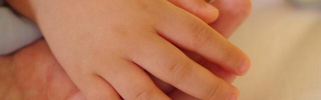 Roditelji prijavili osip kod dece, iz beogradskih vrtića povlači se sapun „Kids Oxy“