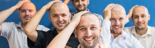 Konkurs koji je šokirao javnost: Kompanija zapošljavala samo ćelave - razlog će vas oduševiti