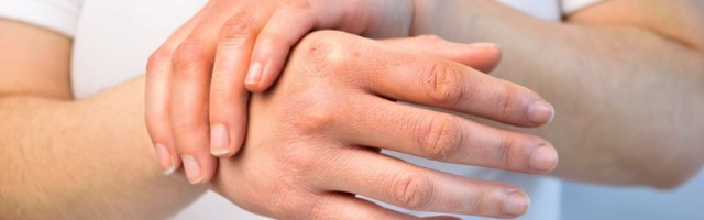 Kozmetičarka OTKRILA recept za negu suvih ruku kod kuće
