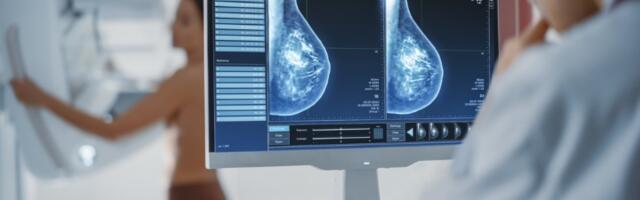 "Mamograf u Domu zdravlja Savski venac ne radi dve sedmice, nadležni ne reaguju"