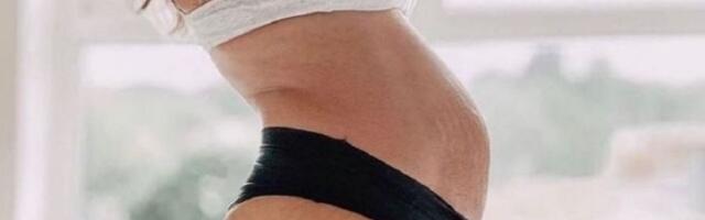 "Deca su vredna ovog stomaka": Mame ponosno pokazale tela