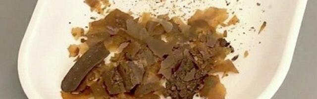 Naučnici potvrdili: Stari Rimljani su zaista koristili izmet kao lek