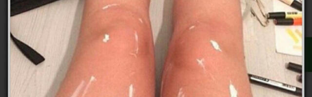 DA LI NA OVIM NOGAMA VIDITE ULJE ILI BELU BOJU? Optička iluzija zaludela internet!