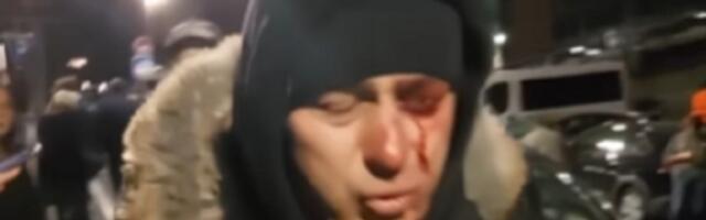 Tužilaštvo i MUP ćute o slučaju policajca Lazara Baćića povređenog ispred RTS-a