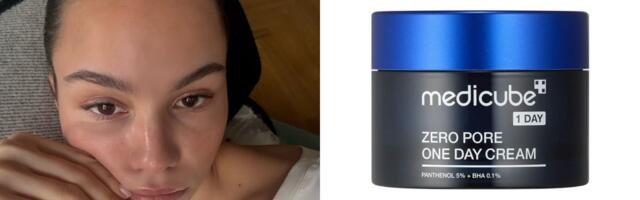 Kreme koje smanjuju proširene pore su pravi spas, a ovo je naš izbor