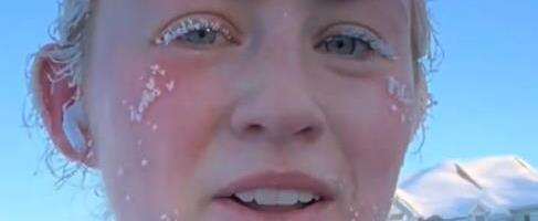 Trčala sam na -22°C i završila u hitnoj: Ono što sam preživela opametilo me je za sva vremena (VIDEO)