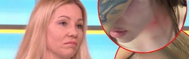 ISPOVEST MAJKE PRETUČENE SESTRE UKI KU! Dijana kroz suze ispričala: Saru sam videla IZDEFORMISANU, pitala me je da li će PREŽIVETI!