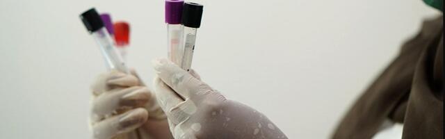 Dve naučnice iz Srbije nominovane za regionalnu nagradu u oblasti medicinskih istraživanja