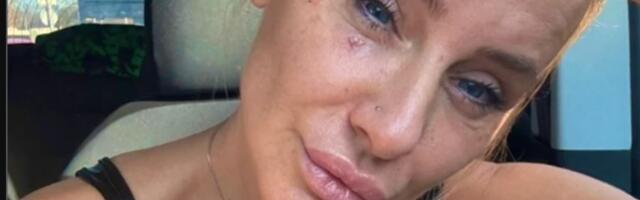"OD JUTRA DO MRAKA U BOLOVIMA!" Milica Dabović OPERISANA ČETVRTI PUT: "Da mi je neko pričao da će trajati 12 dana"