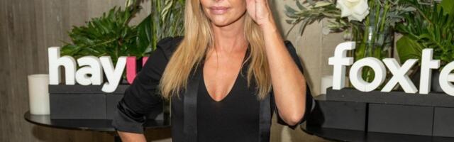 Deniz Ričards šokirala svet: Holivudska lepotica objavila fotografije pre i posle plastične operacije!