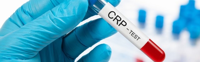 CRP analiza kod dece: Kako se radi i šta pokazuju rezultati krvi