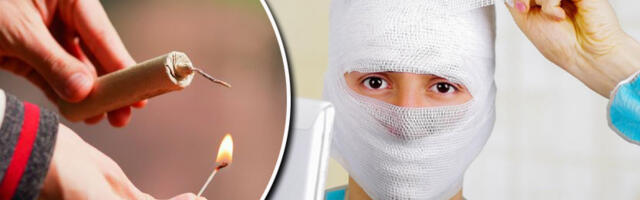 Slike koje niko ne želi da vidi: Statistika povređene dece od pirotehnike je ALARMANTNA