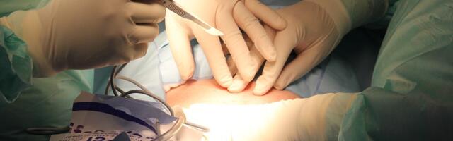 Operisali muškarca zbog bolova u stomaku, pa otkrili šta je 20 godina nosio u sebi: Šok i neverica!