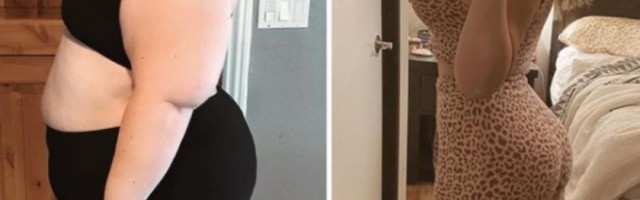 Nakon dečkove prevare, ona je smršala 92 kilograma i dala 20.000 dolara na operacije, sad izgleda kao avion!