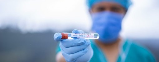 U Republici Srpskoj rekordan broj novoobolelih od koronavirusa