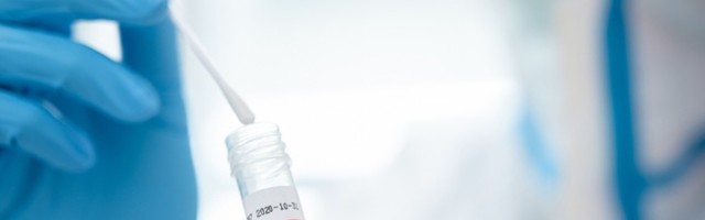 Lekar mu potpisao da izađe iz izolacije, on uradio test i - pozitivan je i dalje: Šta sad?