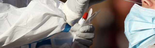 U Srbiji se razvija domaći test na koronu