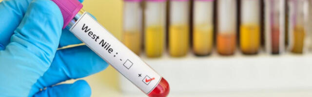 ZDRAVLJE I BEZBEDNOST PUTNIKA NA PRVOM MESTU! Pojačane KONTROLE u više zemalja nakon izbijanja SMRTONOSNOG virusa!