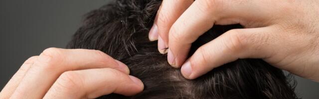 Preko kose se može otkriti ALARMANTNI SIGNAL za Parkinsonovu bolest: Evo šta ukazuje na dijagnozu