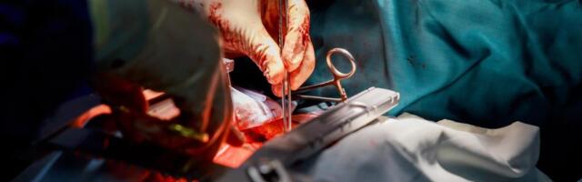 PACIJENTU UGRADILI VEŠTAČKO SRCE! Sada živi BEZ PULSA i na BATERIJE: "Bio je na ivici smrti"