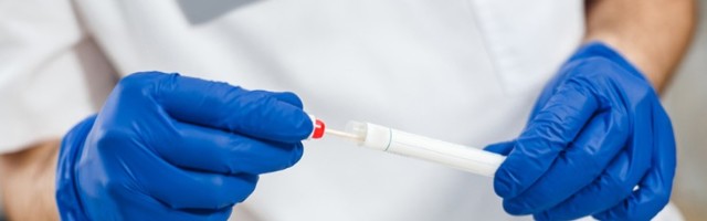 Novih sedam smrtnih slučajeva i 383 zaražena u S. Makedoniji