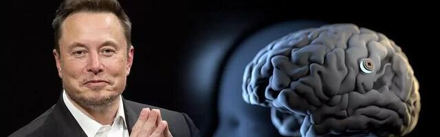 Elon Musk: Ugrađen prvi implantat u mozak čoveka