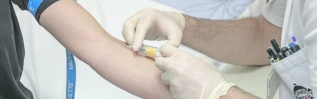 ŠTA BROJ ANTITELA ZAISTA ZNAČI? Stručnjaci Pasterovog zavoda u Novom Sadu razvili test koji pokazuje koliko smo zaštićeni od korone