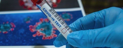 U BIH 35 novih žrtava koronavirusa, pozitivno više od polovine testiranih