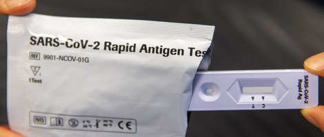 SAD odobrio prodaju brzog testa na korona virus za osobnu upotrebu