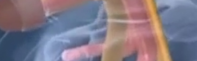 "Kao ženu su me tukli i vređali. Tek kad sam ugradio penis, postao sam srećan"