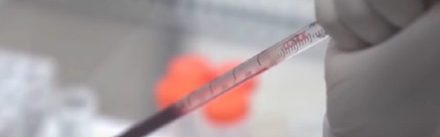 Još 640 zaraženih u S. Makedoniji, umrlo 12 ljudi