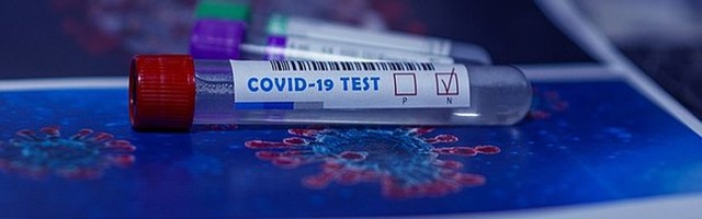 Austrija uvodi PCR test za boravak u bolnici, rezervaciju hotela ili odlazak u pozorište