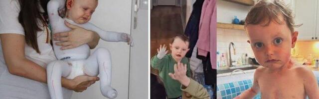 "HVALA ZAUVEK ŠTO STE MI SINU OMOGUĆILI DA ŽIVI"! Dečak leptir Viktor Putica se oporavlja od teške bolesti! OGLASILA SE NJEGOVA MAJKA I POKAZALA SLIKE "NEKAD I SAD"! (FOTO)