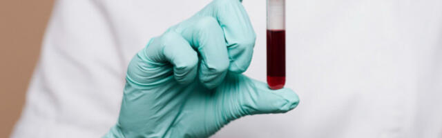 ​Позивају се грађани да дају крв у Светог Саве 39 и на терену