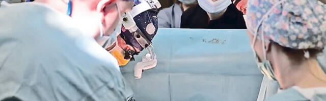 Трансплантација плућа први пут урађена у Србији