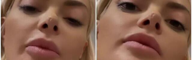 Ela Dvornik pokazala rupu na nosu: "Džabe sam se operisala"