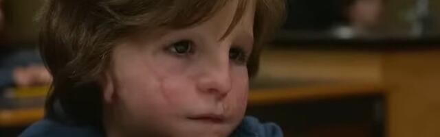 Plašili su ga se, ismejavali, a ceo svet plakao zbog njega: Ovako danas izgleda dečak iz čuvenog filma (FOTO)