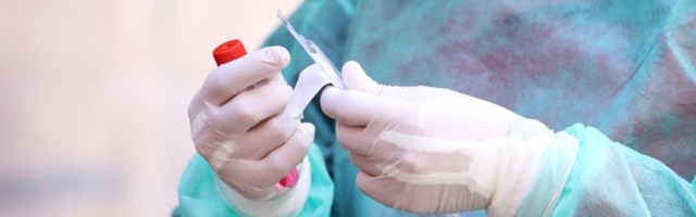 CRNI REKORD Još 35 žrtava koronavirusa u BiH