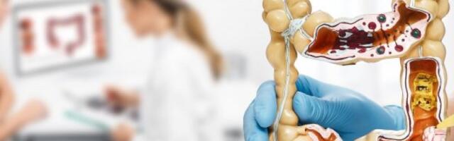 OVAJ RAK KOSI MUŠKARCE U SRBIJI! Evo kako sprečiti najgore!