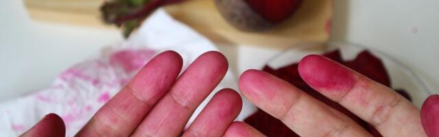 Muke sa cveklom i kurkumom: Otkriven genijalan način da skinete uporne fleke sa prstiju