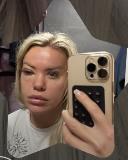 POZNATA VODITELJKA NEPREPOZNATLJIVA Lice izobličeno, oko naduto, crveno: Mnogo me boli... (FOTO)