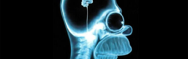 Mozak ljudi je sve manji i nismo iznenađeni