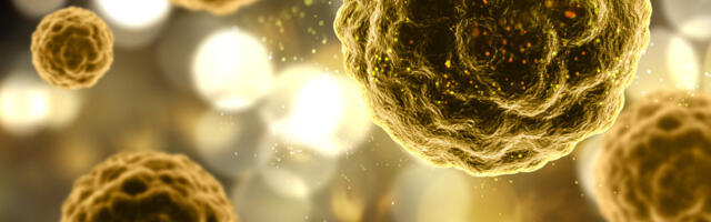 Najnovija metoda u onkologiji: Zamrzavanjem tumora, lakši metod uklanjanja tumorskih ćelija