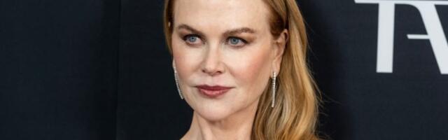 Hitno hospitalizovana Nikol Kidman: Pozlilo joj na snimanju