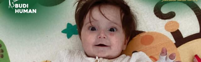 Dorotea je "dete leptir", njena koža je veoma osetljiva: Pomoć joj je hitno potrebna