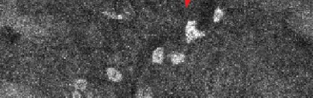 Nova tehnika osvetljava gde lekovi idu u telu, ćeliju po ćeliju