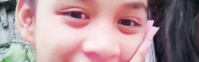 (UZNEMIRUJUĆA SLIKA) Žena je pokušala da ukloni tačkicu sa nosa, a onda joj se desila JEZIVA STVAR - KADA JE VIDE, SVI OSTANU ŠOKIRANI