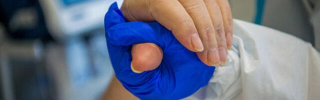 У Србији регистровано 410 оболелих од туберкулозе током прошле године