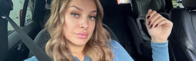 Luna Đogani otišla na remont: Evo šta je uradila na svom licu (FOTO)